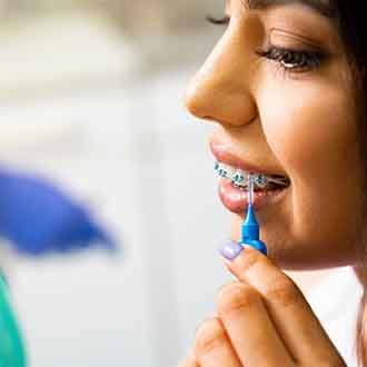 Closeup of patient cleaning braces with interproximal toothbrush